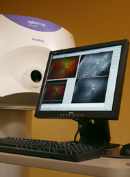 Optomap Retinal Exam